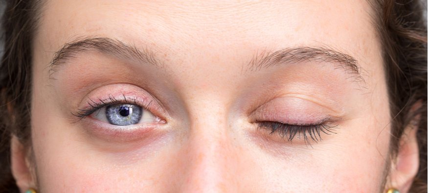 Close up of a young woman with blue eyes and one of her eyelids is closed