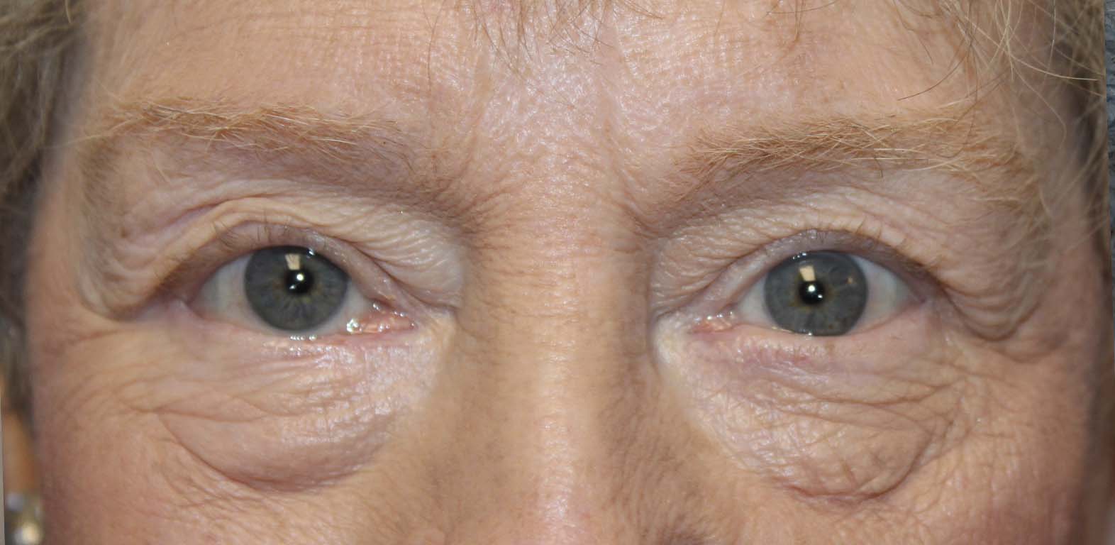 70 year old woman close up of eyes