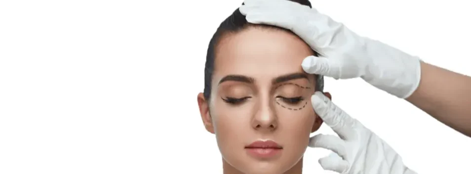 Woman getting marked for oculoplastic surgery