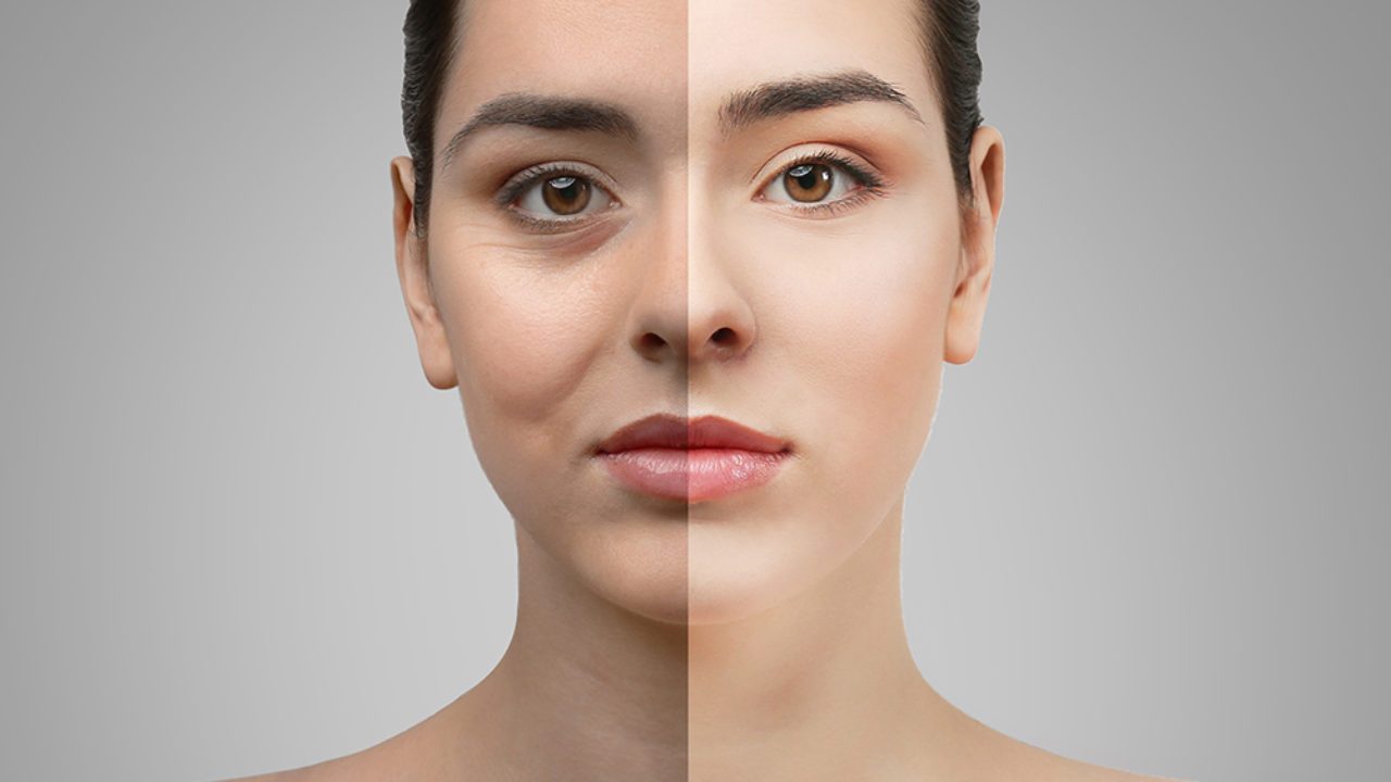 Split screen image of before and after results of a female after cosmetic sugery