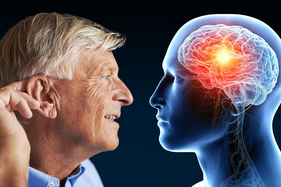 Hearing impairment is associated with cognitive decline, brain