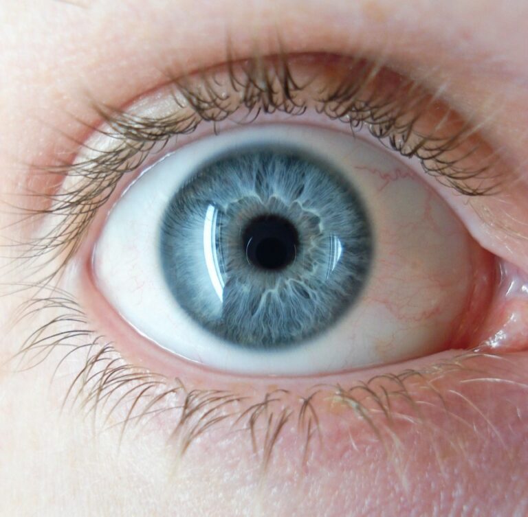 image of a blue eye