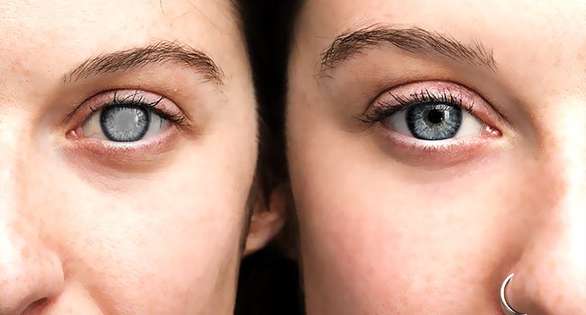 two people in a close up image of two eyes