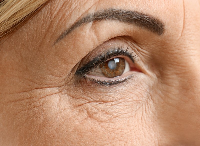 close up image of a womens eye
