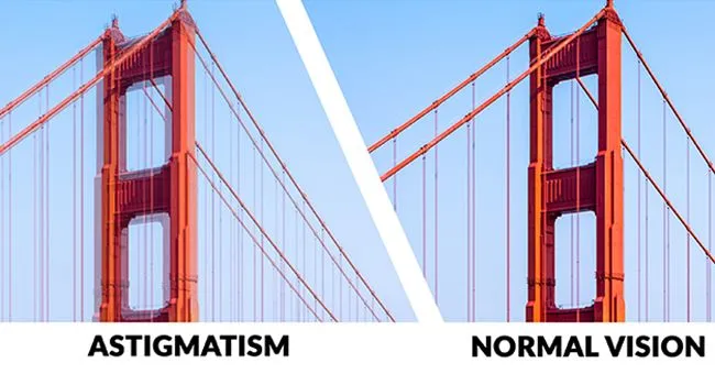 Astigmatism vs. normal vision