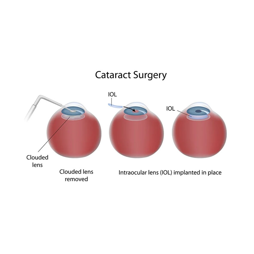 Cat-Surgery
