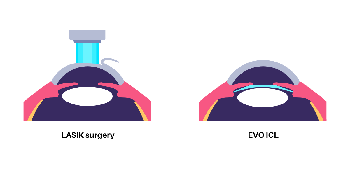 LASIK and EVO ICL eye surgery. Correction of vision diseases. Nearsightedness, farsightedness, astigmatism treatment with laser or lens implantation. Safe painless procedure human eye