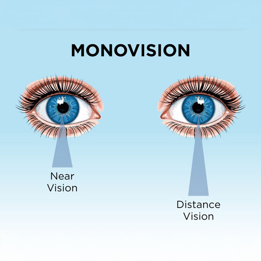 Monovision
