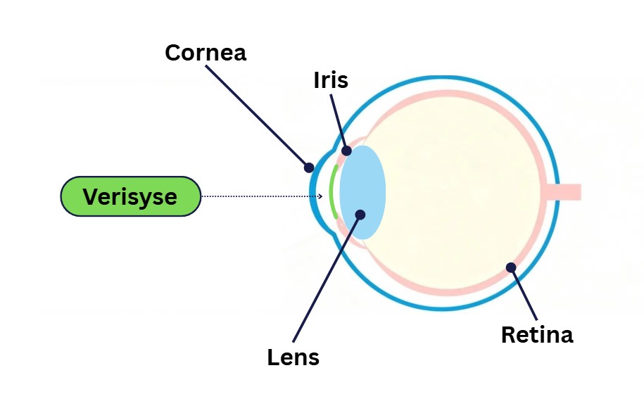 Verisyse