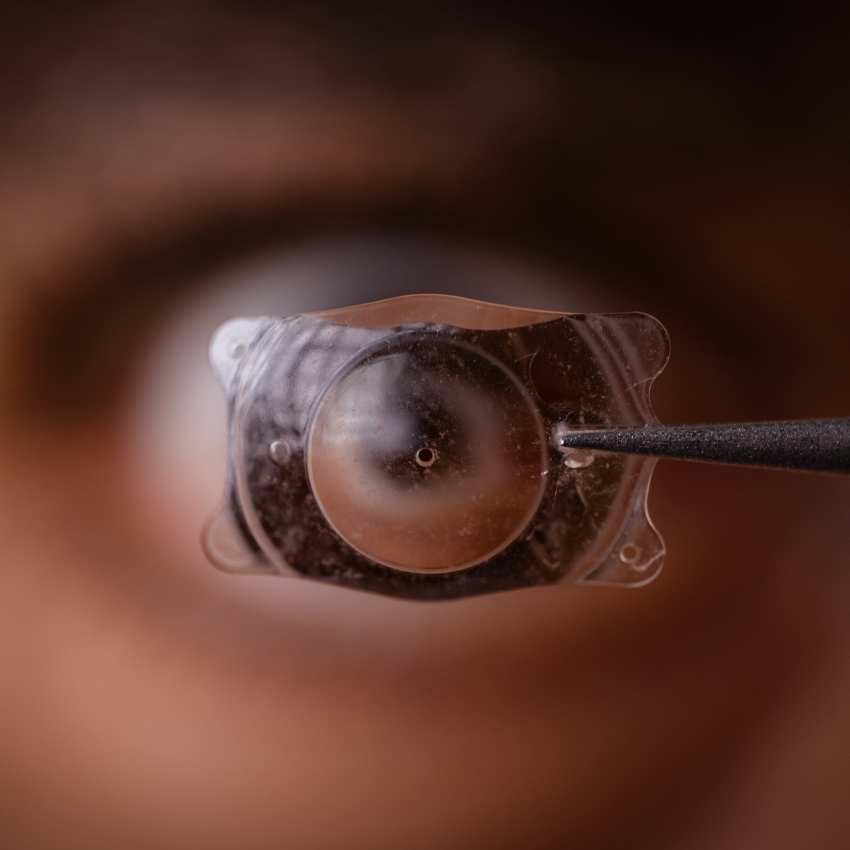 photo of Implantable Collamer Lens ICL for treating refractive errors, infront of a human eye