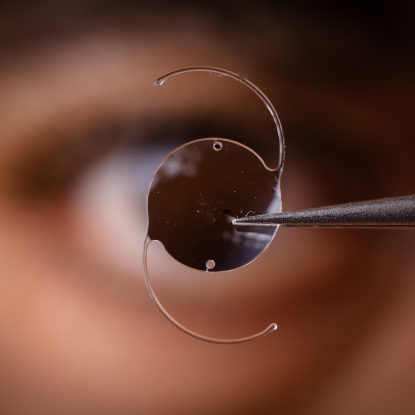 photo of intra ocular lens IOL for treating cataract infront of surgeon eye