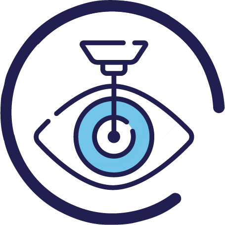 Laser Cataract Surgery
