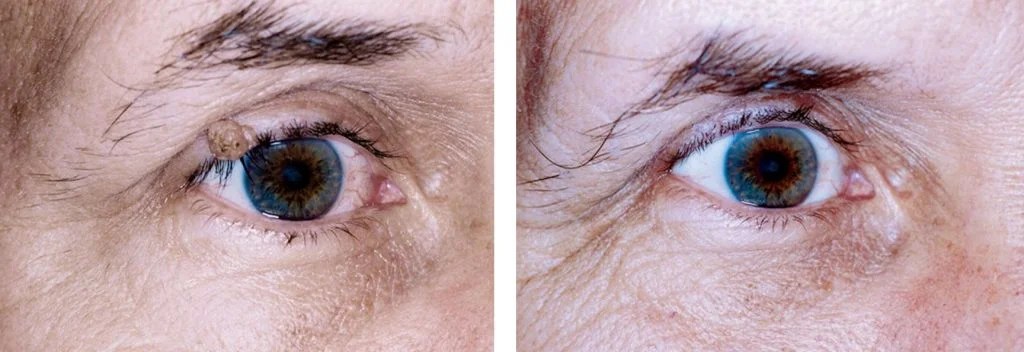 before-after-1-1024x352