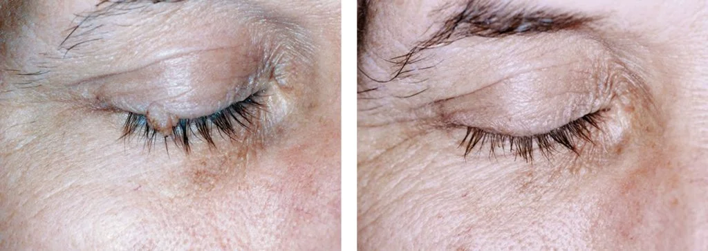before-after-10-1024x363
