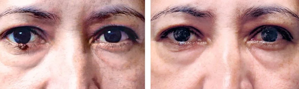 before-after-11-1024x306
