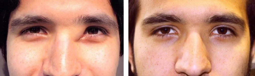 before-after-12-1024x306