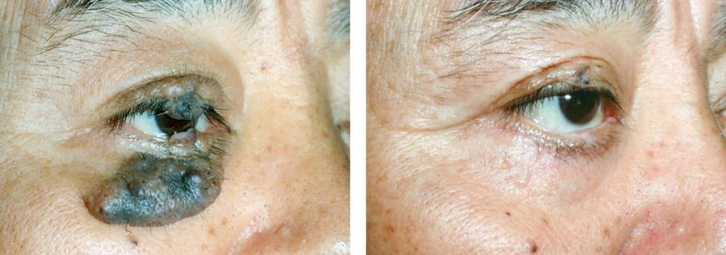 before-after-13-1024x360