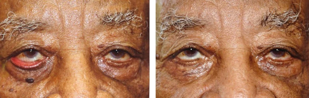 before-after-14-1024x324