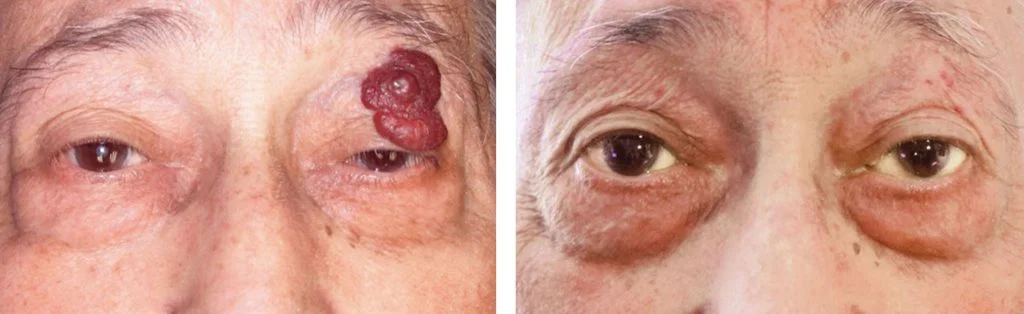 before-after-2-1024x314