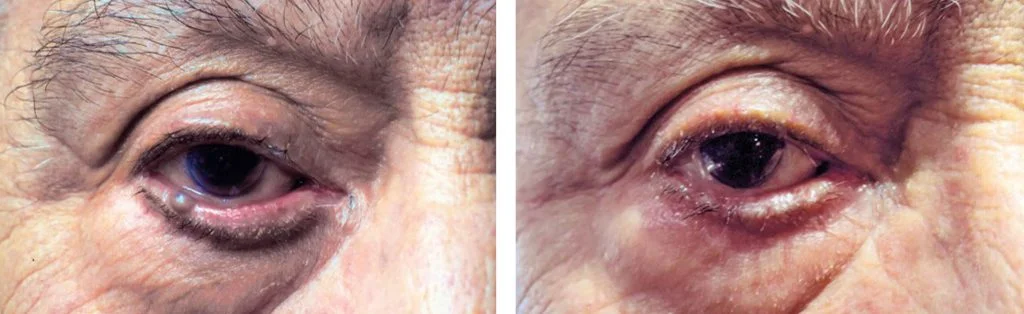 before-after-3-1024x314