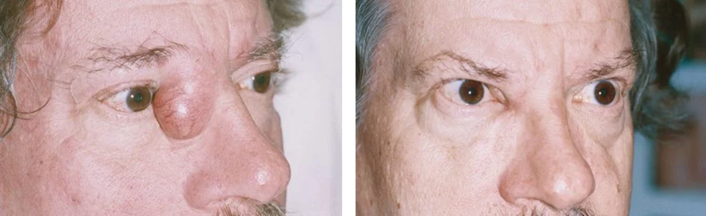 before-after-4-1024x314
