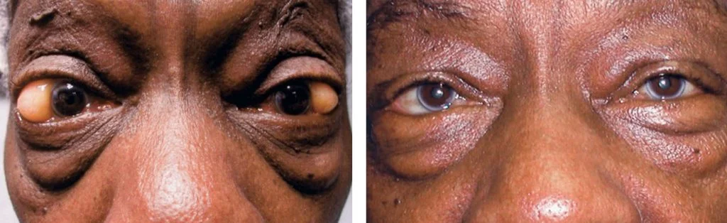 before-after-5-1024x314