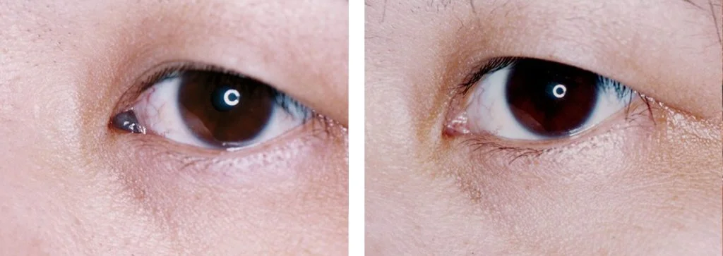 before-after-6-1024x363