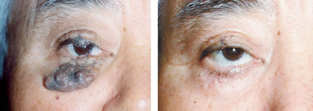 before-after-7-1024x363