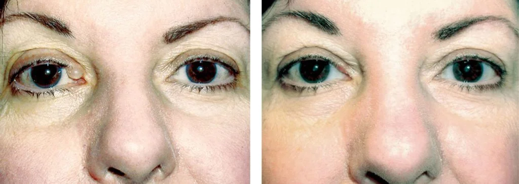 before-after-8-1024x363