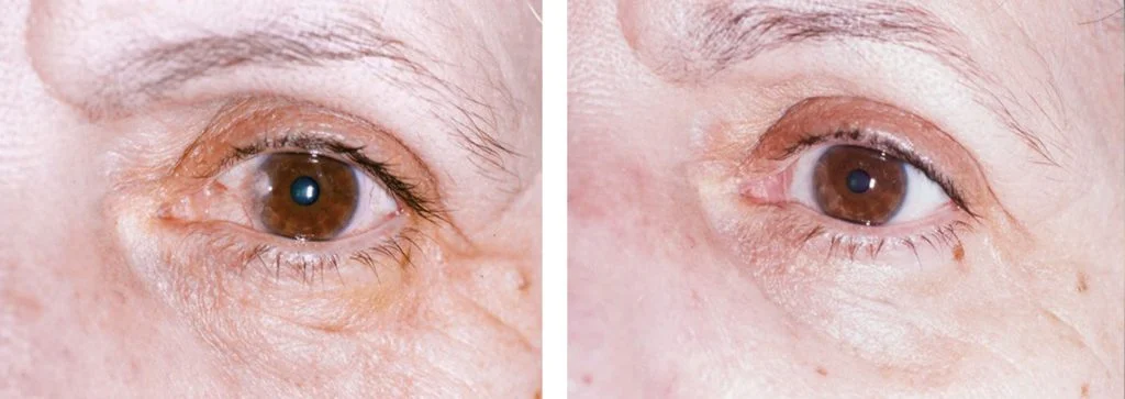 before-after-9-1024x363