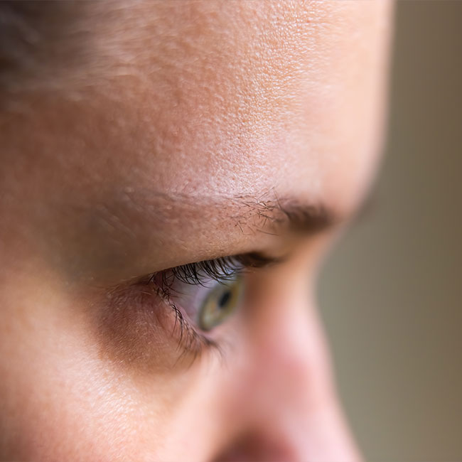 Macro-closeup-of-young-woman-face-portrait-in-profile-side-with-Grave's-disease-hyperthyroidism-symptoms