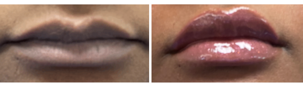 Mileo - Filler - 1