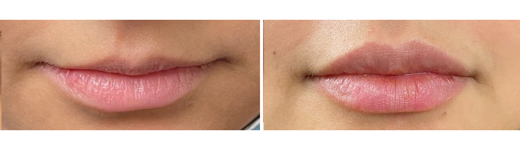 Rafailov - Filler - 1
