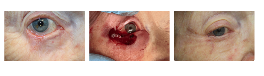 Rafailov - Skin Cancer - 1