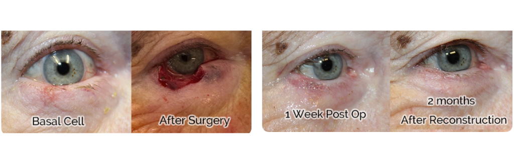 Rafailov - Skin Cancer - 2