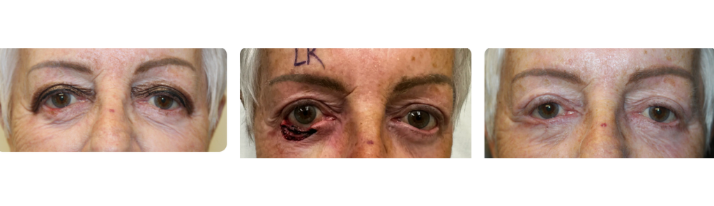 Rafailov - Skin Cancer - 3