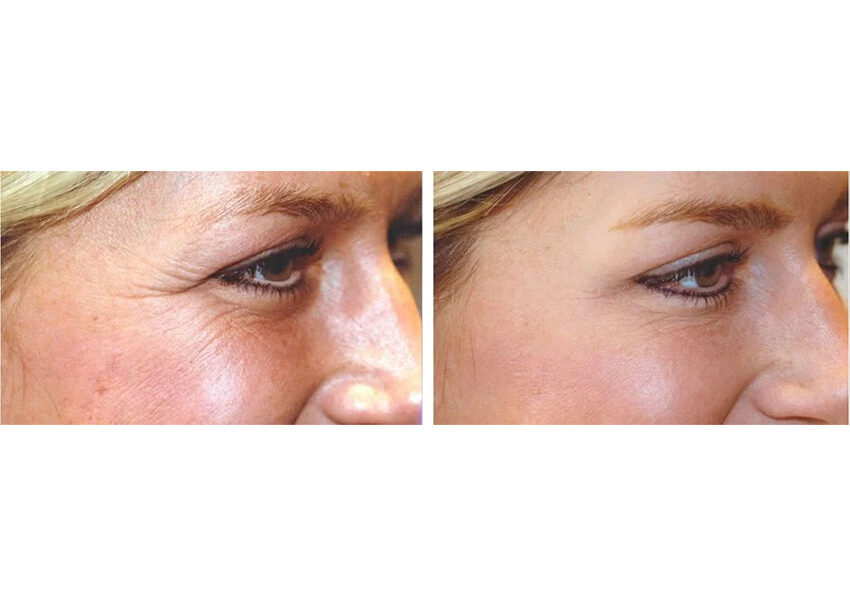 B&A