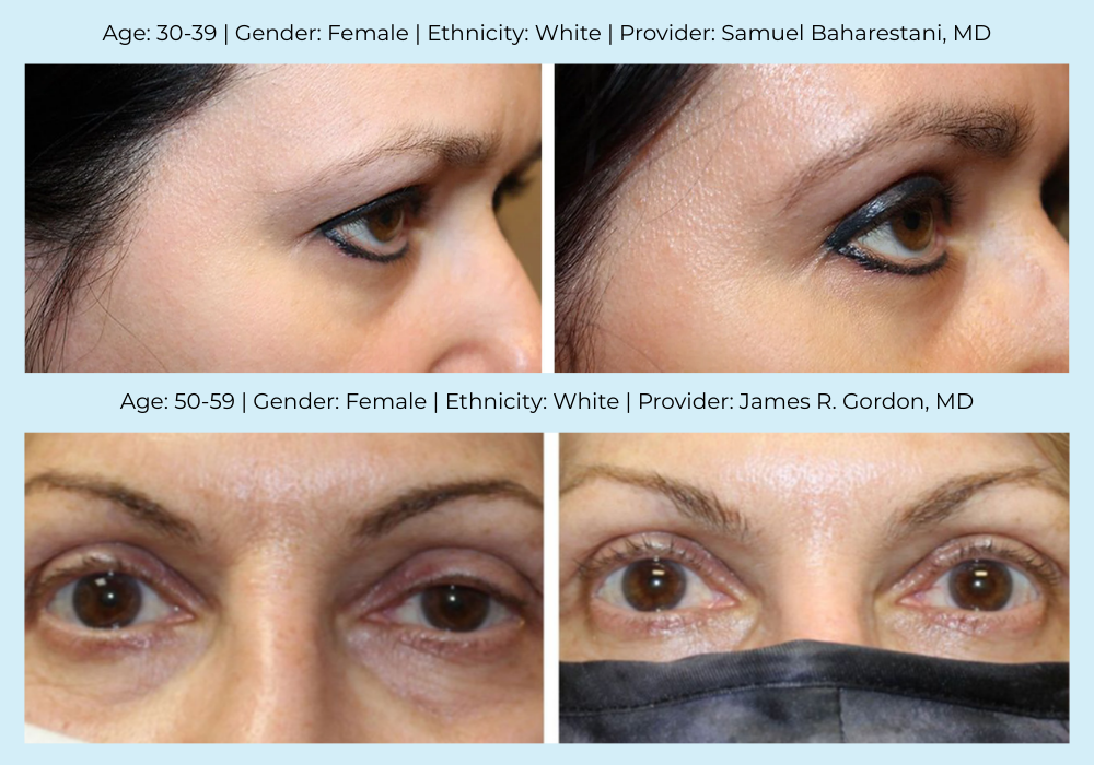 Before and after images of patient