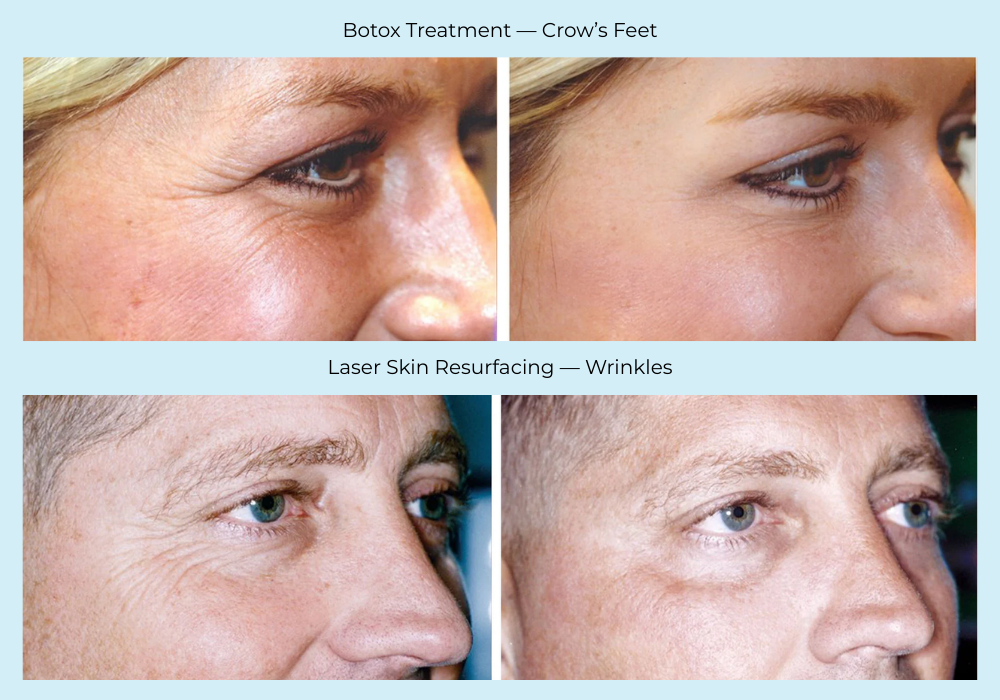 Patient Cosmetic Treatment Before and After